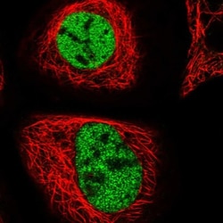ZMIZ2 Antibody, Novus Biologicals 25 &mu;L; Unlabeled:Antibodies, Polyclonal